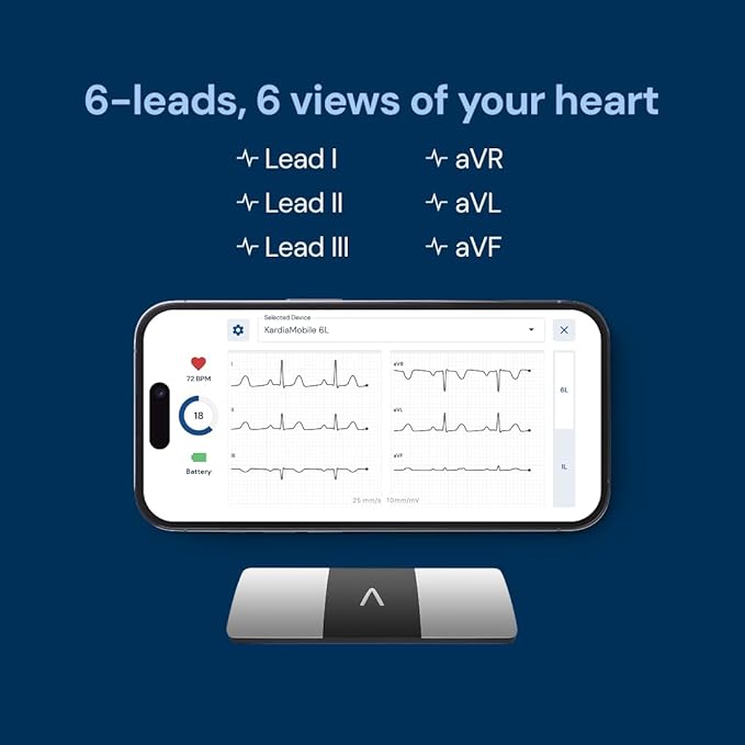 KardiaMobile 6-Lead Personal EKG Monitor ??Six Views of The Heart ??Detects AFib and Irregular Arrhythmias ??Instant Results in 30 Seconds ??Works with Most Smartphones
