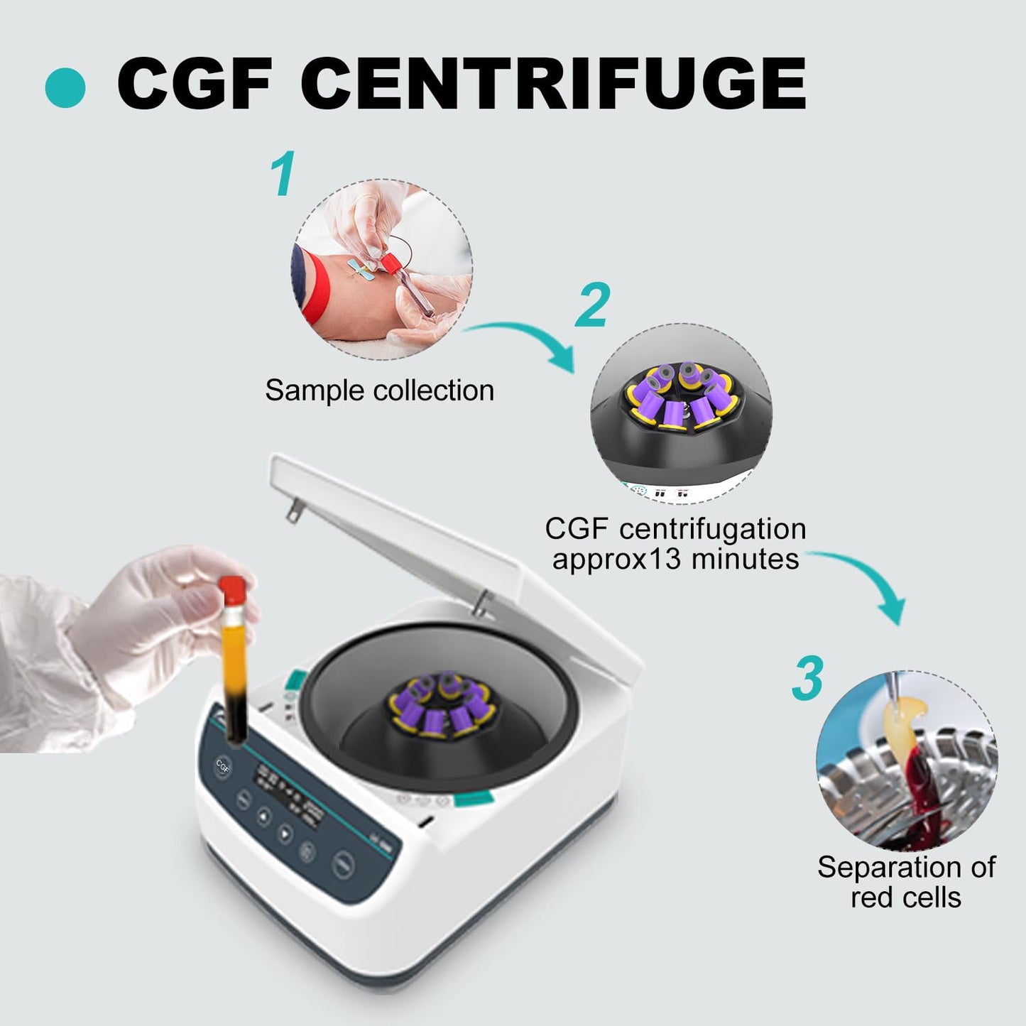 JOANLAB LC500-8P Lab Centrifuge with 4 Preset Programs - CGF/PRP/APRF/IPRF, 500-4000 RPM, 1967 x g, Holds 15ml & 2/5/10ml Tubes