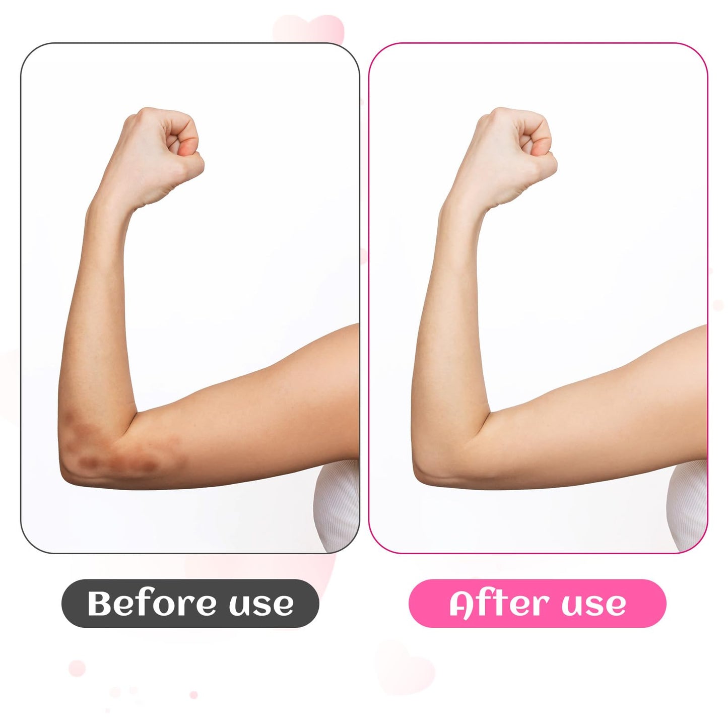 Piriuuo 2 Pairs/4 Pcs Elbow Moisturizing Sleeve, Elastic Gel Elbow Pads for Women, Soft Sleeve Elbows Protector for Spa Moisturizing Dry Cracked Skin Care (Pink)
