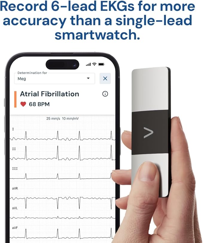KardiaMobile 6-Lead Personal EKG Monitor ??Six Views of The Heart ??Detects AFib and Irregular Arrhythmias ??Instant Results in 30 Seconds ??Works with Most Smartphones
