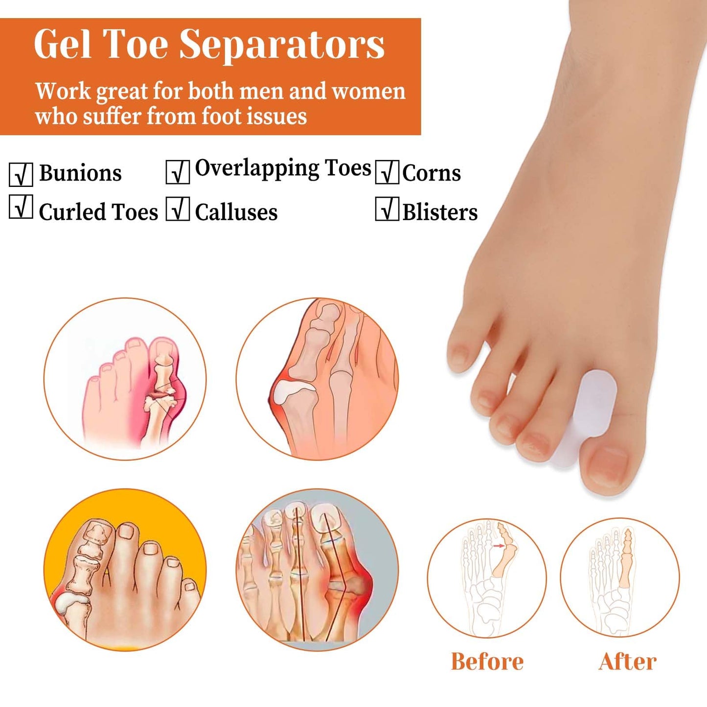 12Pcs Bunion Corrector Gel Toe Separators Soft Toe Spacers Overlapping Toes Pads Gel Orthotics for Men Women Sports Activities Calluses Crooked Toes Hammertoe Straighten Pain Relief (6L)