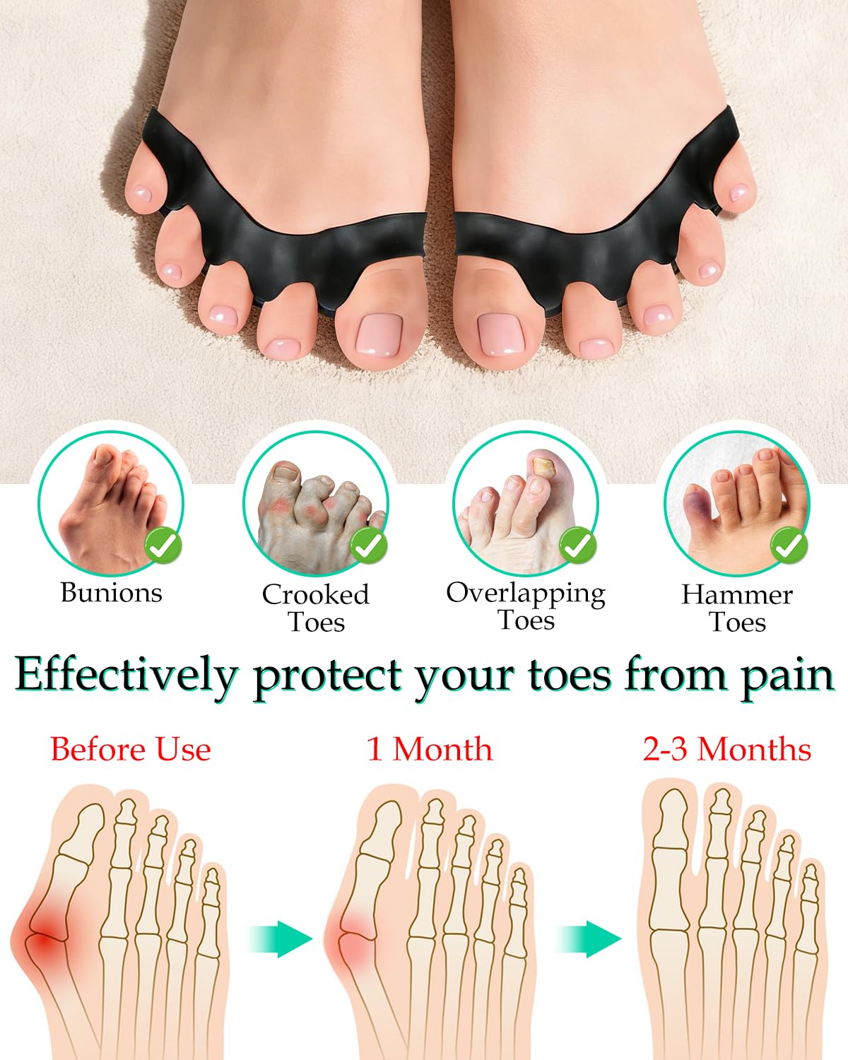 DLMDLM 4PCS Silicone Toe Separators to Correct Toes Alignment for Women and Men, Toe Spacers Straightener for Bunion Relief, Hammertoes and Overlapping Toes (Large)