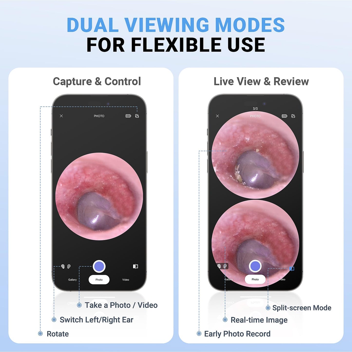 ScopeAround Otoscope, 720PHD Ear Scope Set, Digital Otoscope w/1.85in IPS Screen, Ear Wax Removal Tool Camera, Video Otoscope Ear Camera with 6 LED Lights, Compatible with Android/iPhone