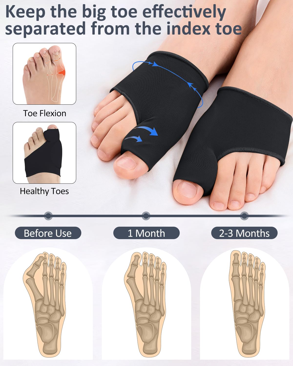 PGRODE 2 Pcs Bunion Corrector Toe Spacers Separators for Women Men Pain Relief, Big Toe Straighteners, Breathable Bunion Cushion Socks with Built-in Gel Pad (Black)