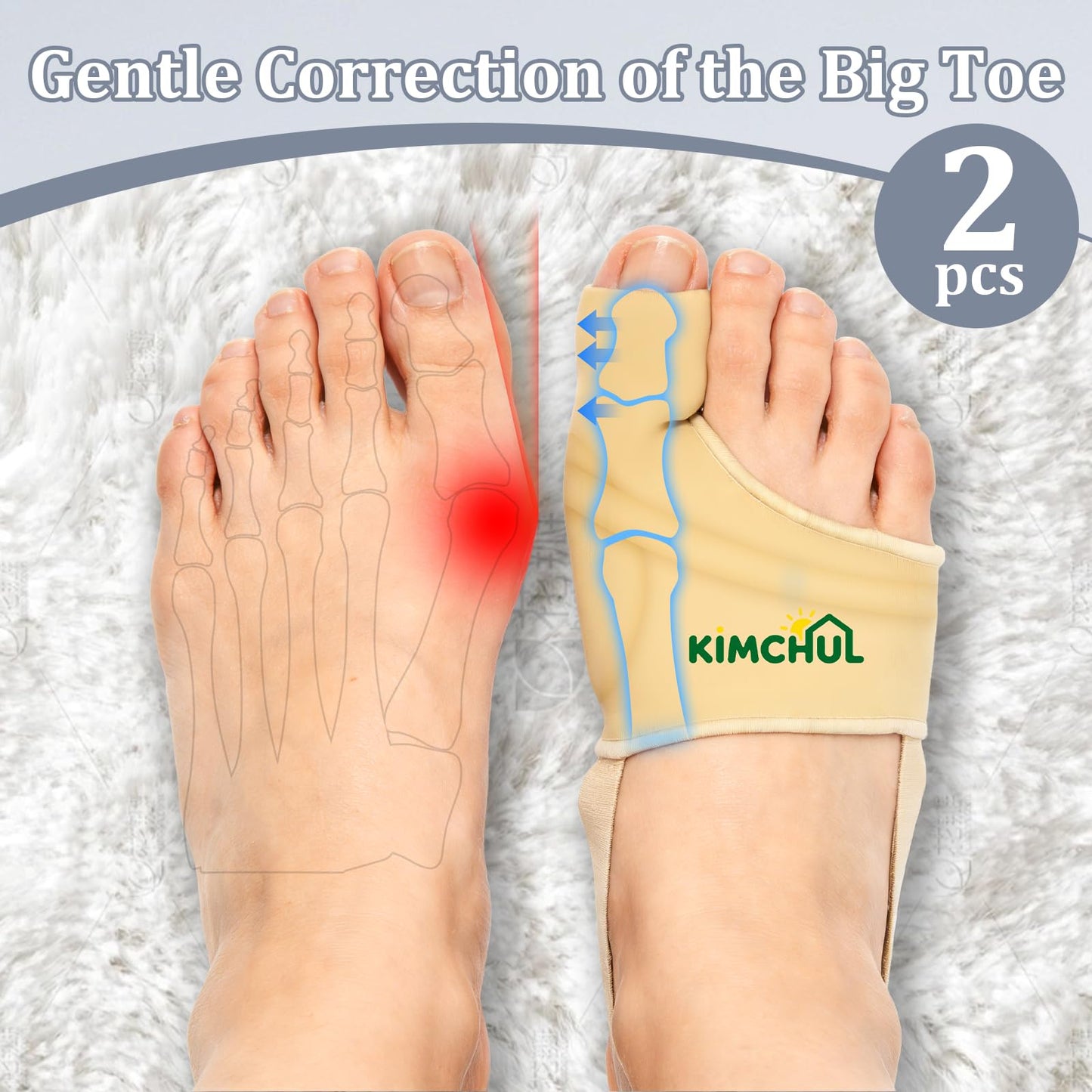 KIMCHUL 2-Pack Bunions Corrector, Unisex, Upgraded Version—Separates the big toe to relieve pain, breathable support-style bunions corrector for day and night use