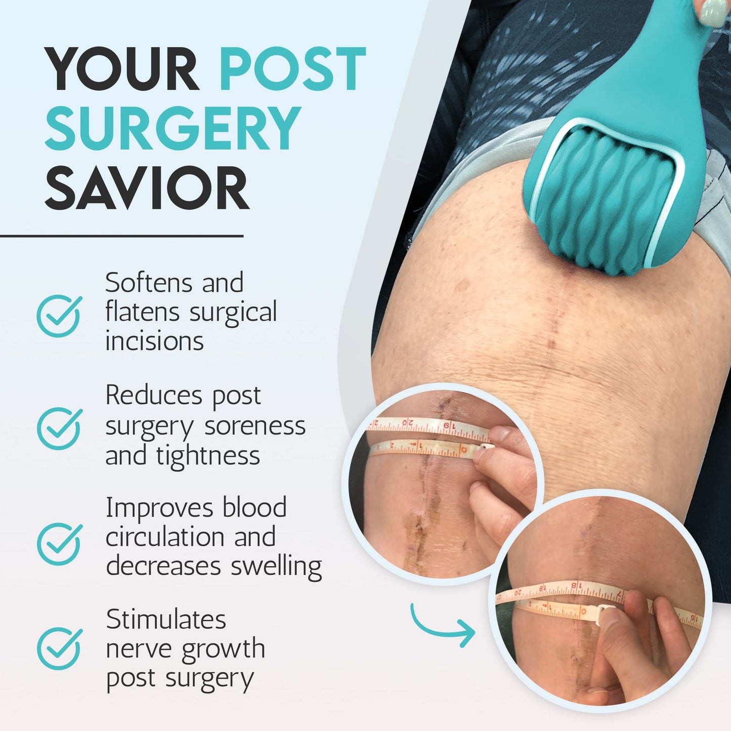 scarroller Scar Tissue Massager for Post-Surgery Recovery, Silicone Ice Massage for Post-Surgery Incision Swelling and Soreness, Joint Roller for Improved Range of Motion and Flexibility. Teal