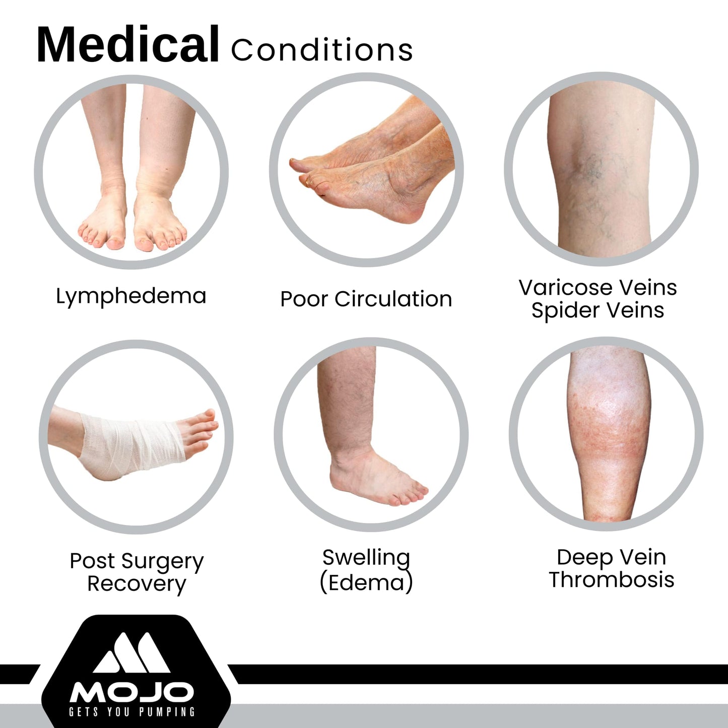 Mojo - Compression Socks Footless for Women and Men 20-30mmHg - Extra Wide Calf Compression Sleeve for Lymphedema, Varicose Veins Circulation - Black, 5X-Large - A604
