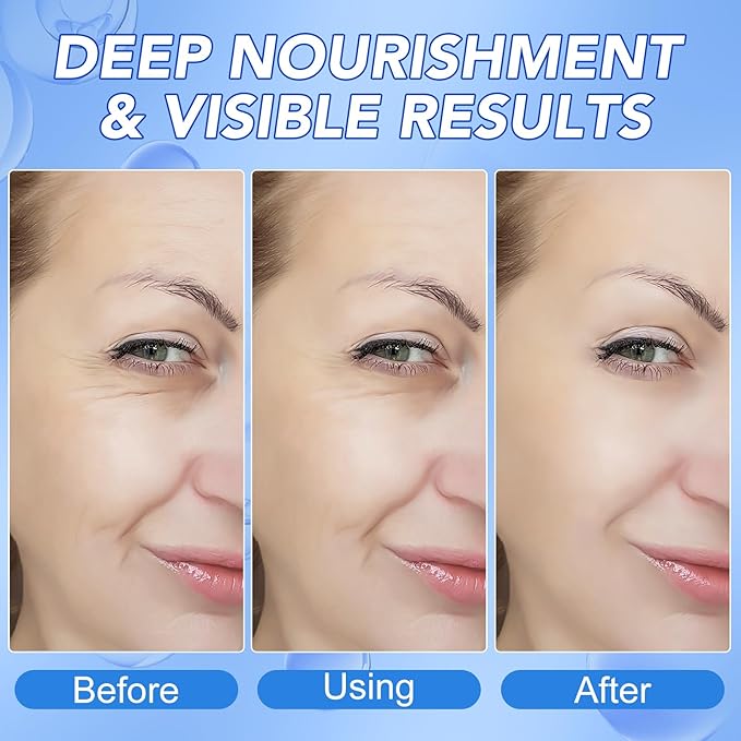 Collagen Face Mask,Collagen Real Deep Mask,Collagen Mask,Deep Hydrating Anti Wrinkle Lifting Mask,Hydrogel Masks for All Skin Types 34g*4ea