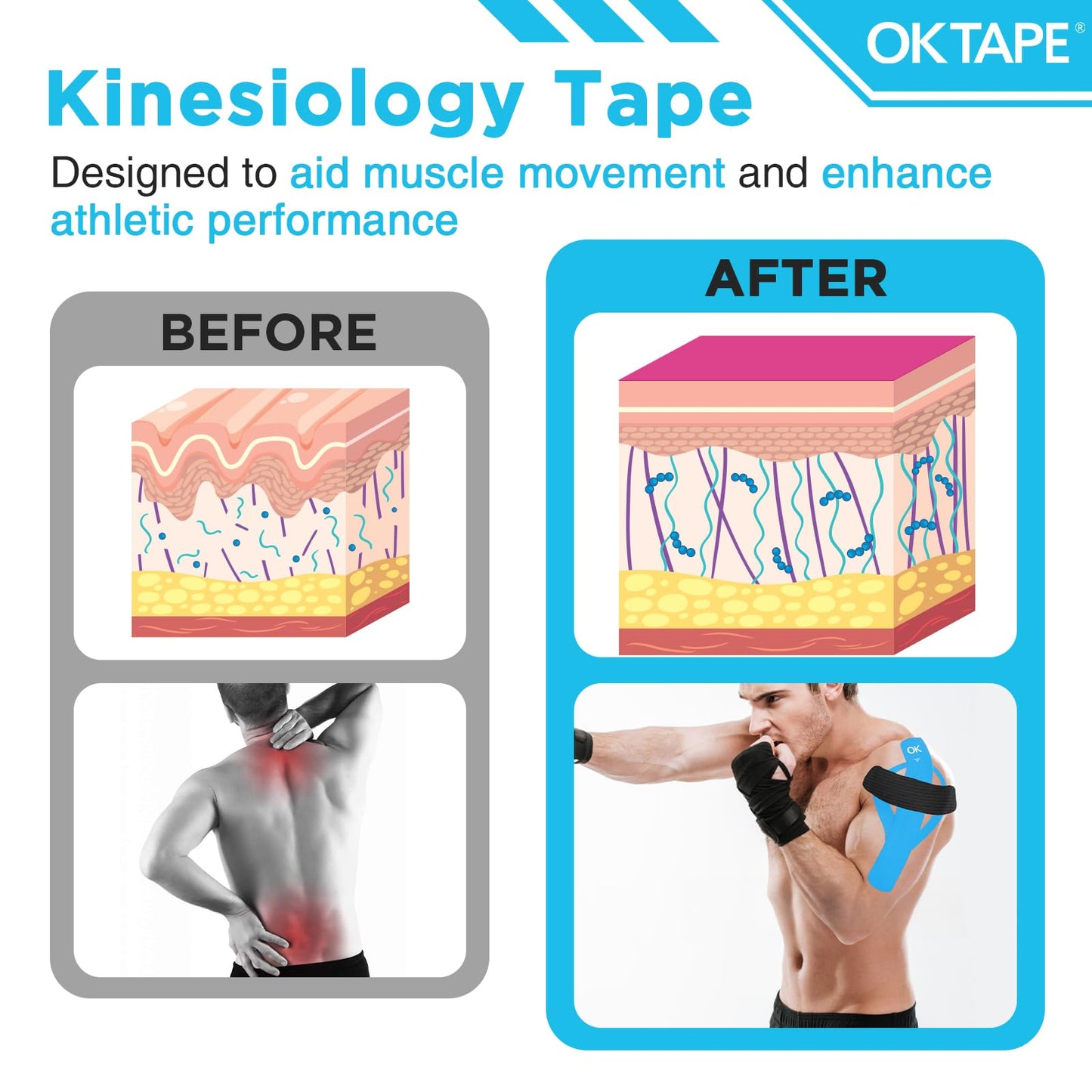 OK TAPE 100Pcs Precut Kinesiology Tape Strips, Elastic Athletic Tape for Joints Support & Muscle Pain Relief, Waterproof, Kinetic Tape for Shoulder, Knee, Ankle (5 Colors, 2 inch x 10 inch)