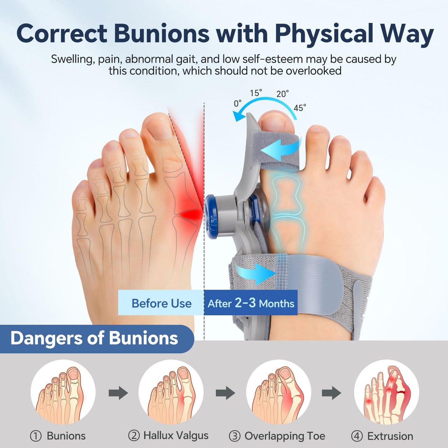 2 Pack Bunion Corrector for Men Women, Toe Splints for Straightening, Adjustable Knob Toe Splint with Silicone Pads, Big Toe Straightener Corrector, Bunion Relief Brace with Dual Toe Straps, Night & Day Use