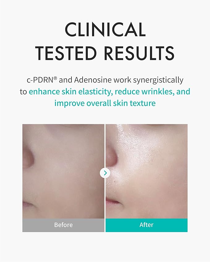 REJURAN® Turnover Mask, c-PDRN® (5ea) ??Original Salmon DNA for Firming, Hydration, Repairing & Revitalizing. Achieve Youthful, Radiant Skin. Korean Skincare. Ultra Microfiber Sheet Mask