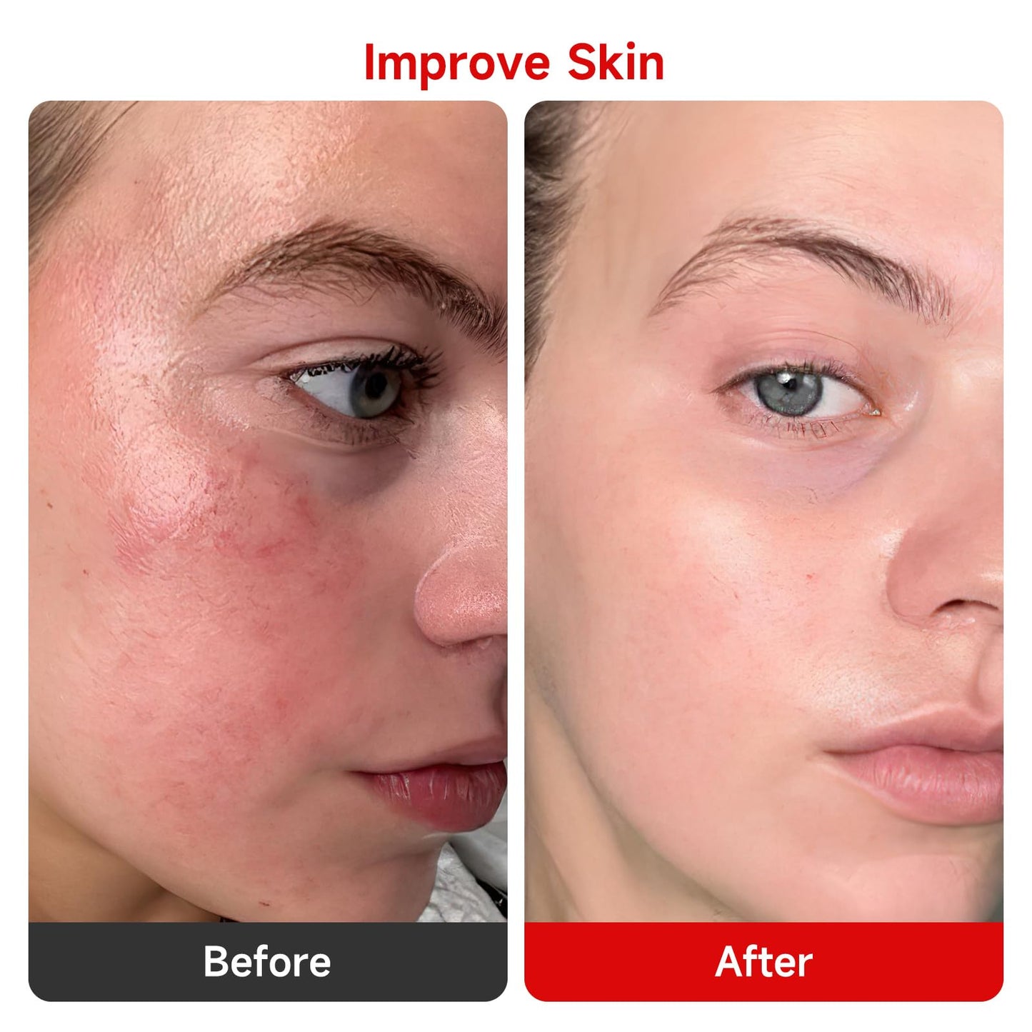 Red Light Devices for Face Full Body Red Light Lamp High Power Infrared Light Panel for Skin Health 660nm