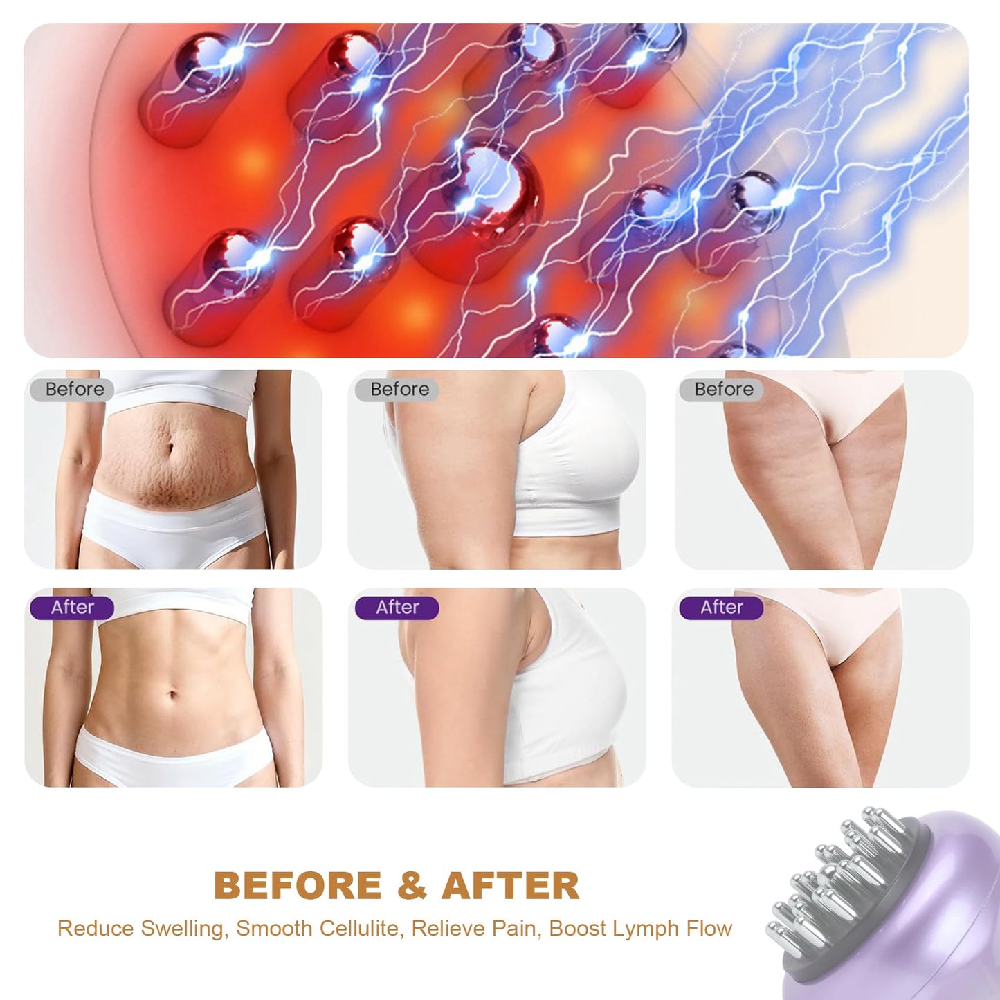 SHANOER 4-in-1 Lymphatic Drainage Massager - Anti Cellulite Massage Tool with Heating/Vibration/Red Light/Microcurrent,Body Sculpting Machine for Legs/Belly/Back/Hips/Reduce Stretch Marks & Cellulite