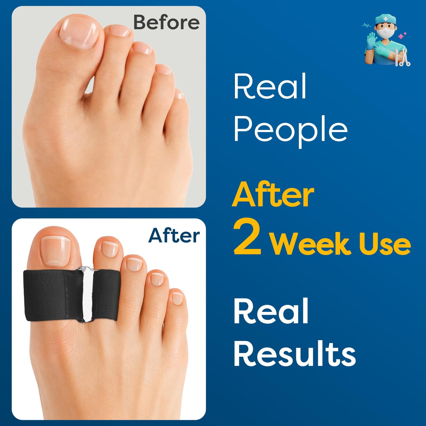 BCCKLE Big Toe Separator,2-Loop Toe Alignment Corrector - Relieve Bunion & Overlapping Toe Pain, Day & Night Soft Gel Sleeve, 3 Sizes, Machine Washable.