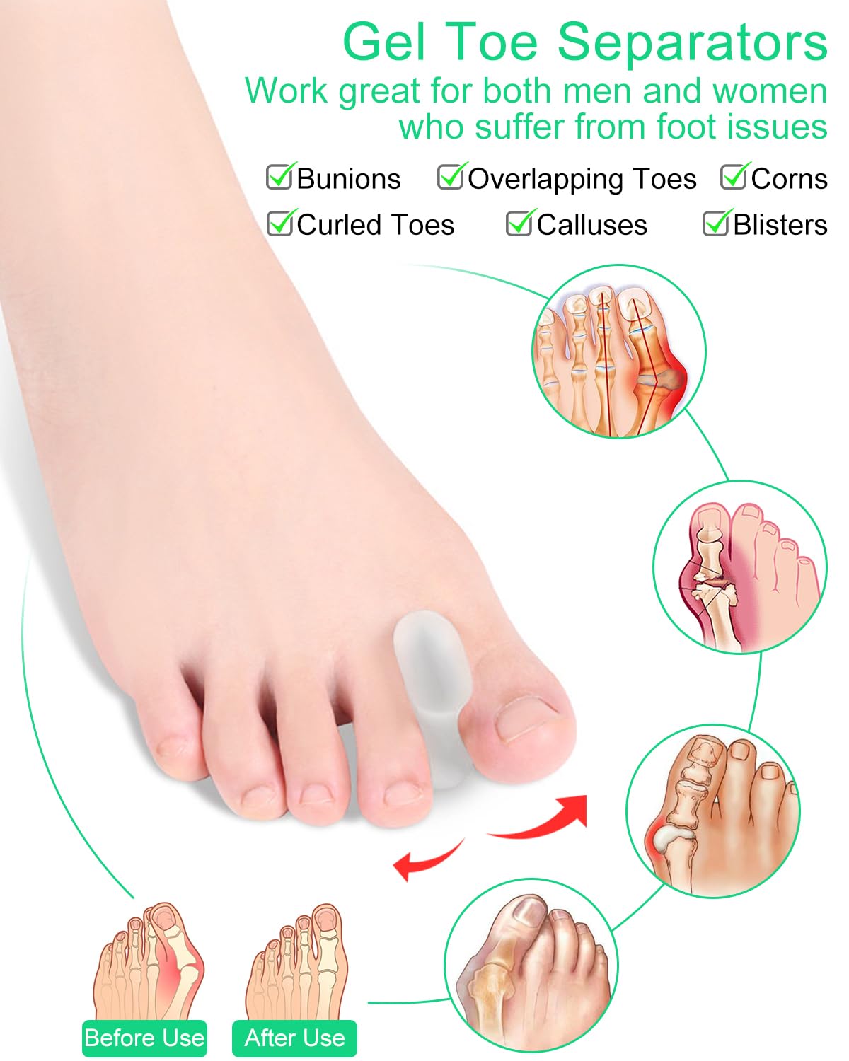 PGRODE 12 Pack Gel Toe Separators Silicone Toe Spacers for Women Men Bunion Corrector Toe Pain Relief, Toe Alignment, Soft Toe Spacer for Crooked Toes, Overlapping Toes, Hammertoe Correction (Large)