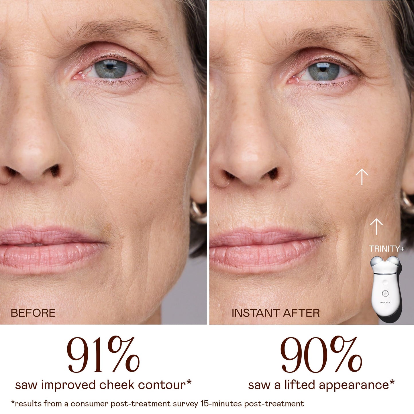 NUFACE Trinity+ Facial Massager - Face Firming & Toning Device for Lines & Wrinkles Treatment - FDA-Cleared Wrinkle Reducer + Lip & Eye Attachment + Aqua Gel Activator - 3 Frequency Microcurrent