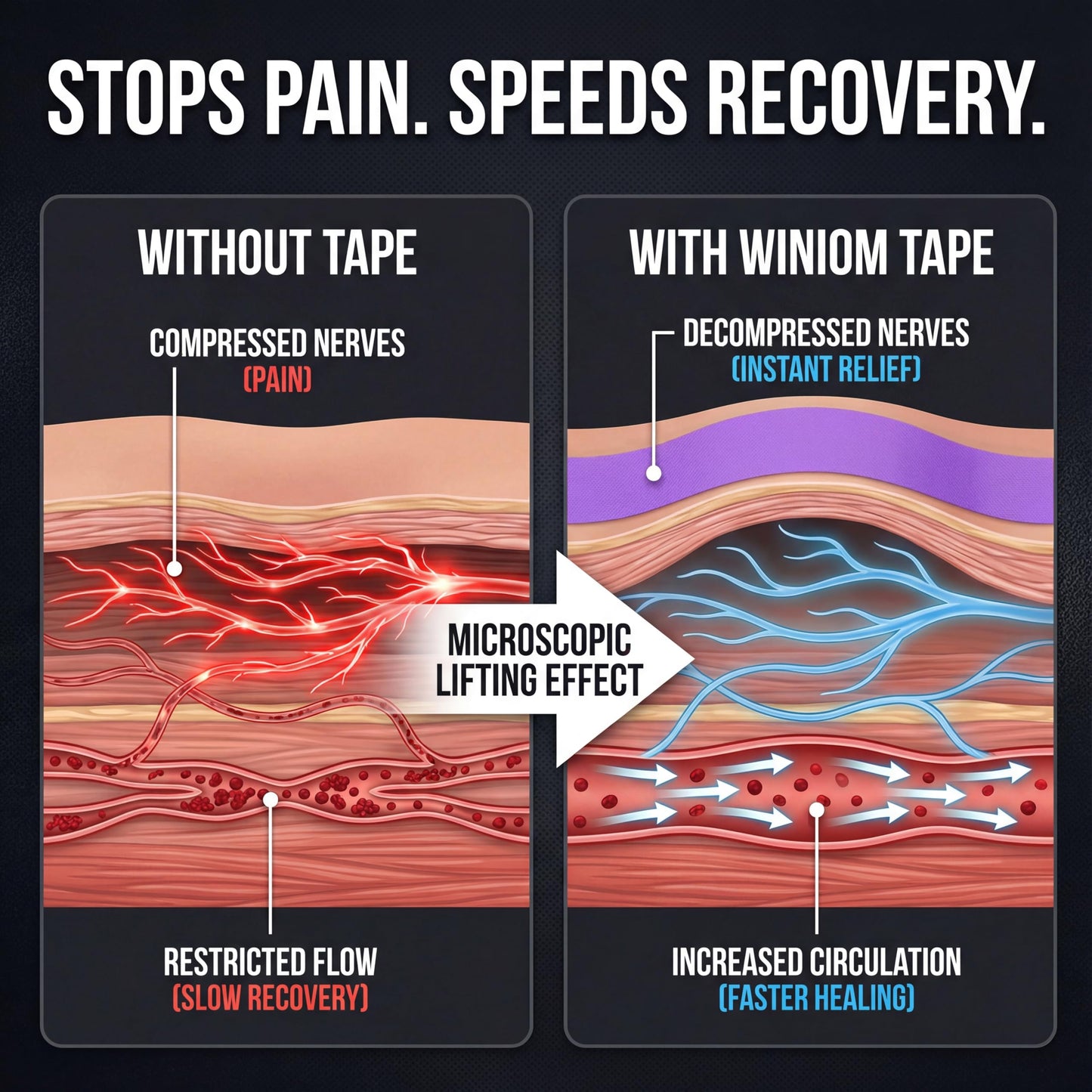 WINIOM Kinesiology Tape - Waterproof Athletic Sports Tape for Knee, Shoulder, Arm & Back Support | 3-5 Day Adhesion, Hypoallergenic & Latex-Free + Taping Guide (Uncut, 2" x16.4ft Roll, Indigo Purple)