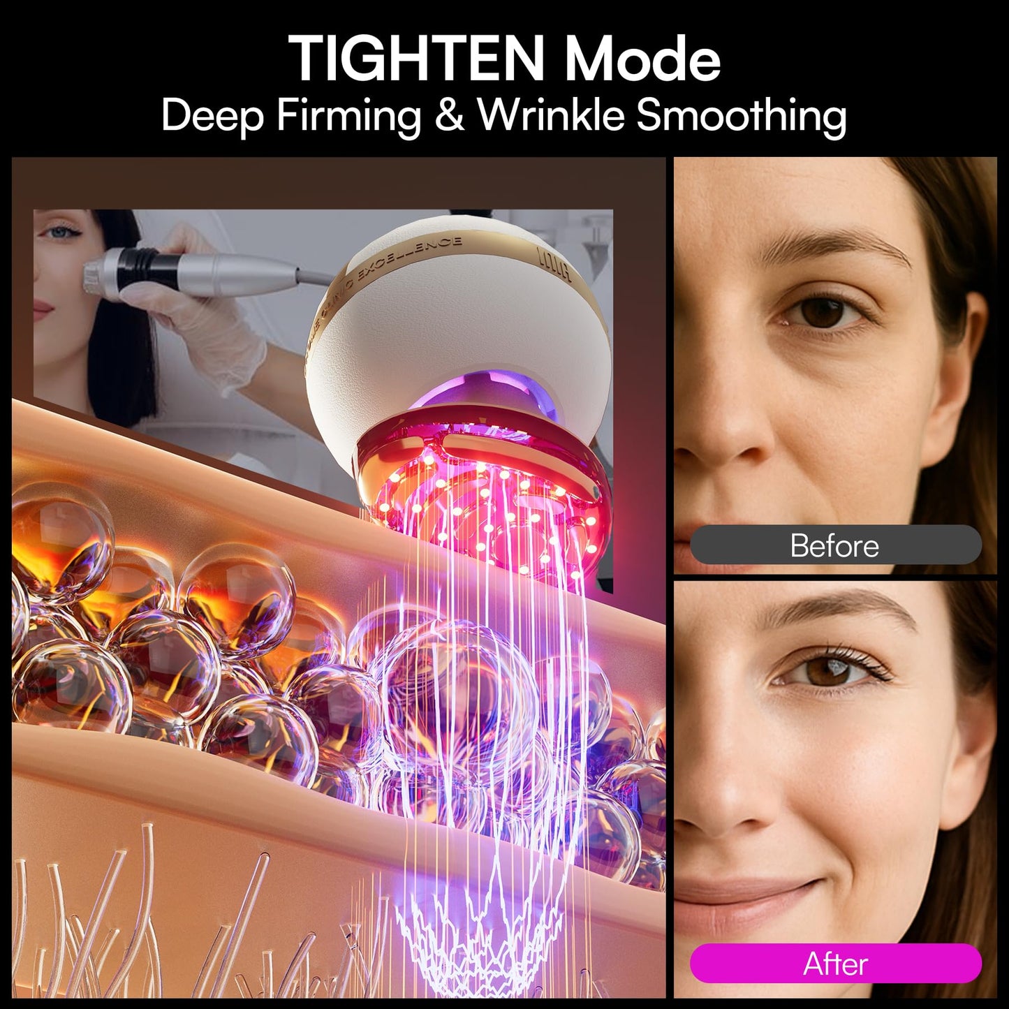 INIA SPHERA Upgraded 8-in-1 Microcurrent Facial Device for Face & Neck – Red Light, Thermal & Cooling Beauty Tool, 5 Custom Modes, At-Home Skin Stimulation & Glow Care Skincare Tool