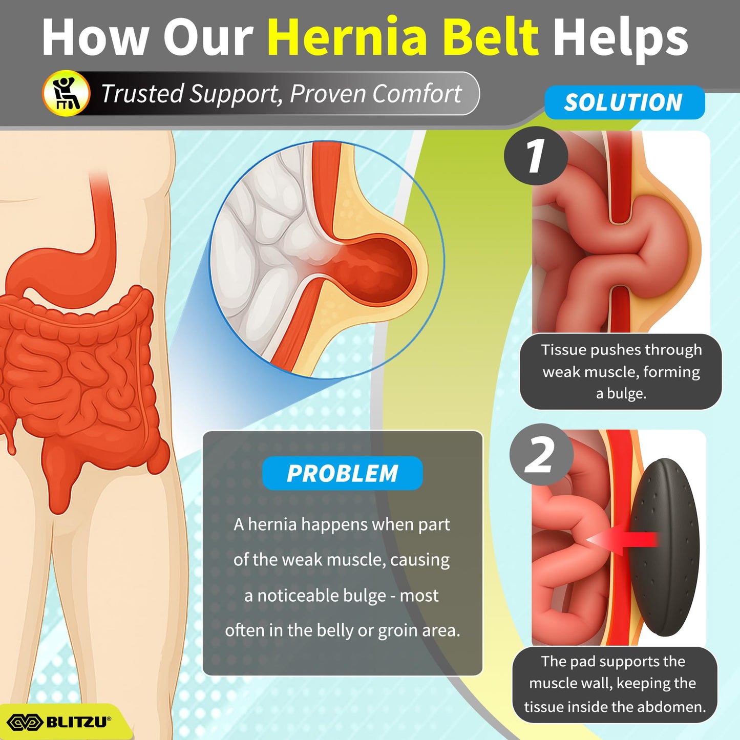 BLITZU Umbilical Hernia Belt for Men & Women, Abdominal Binder Adjustable Truss Support with 2 Compression Pads for Naval, Ventral, Incisional, Epigastric, Belly Button Hernias, Pre Post Surgery L-XL