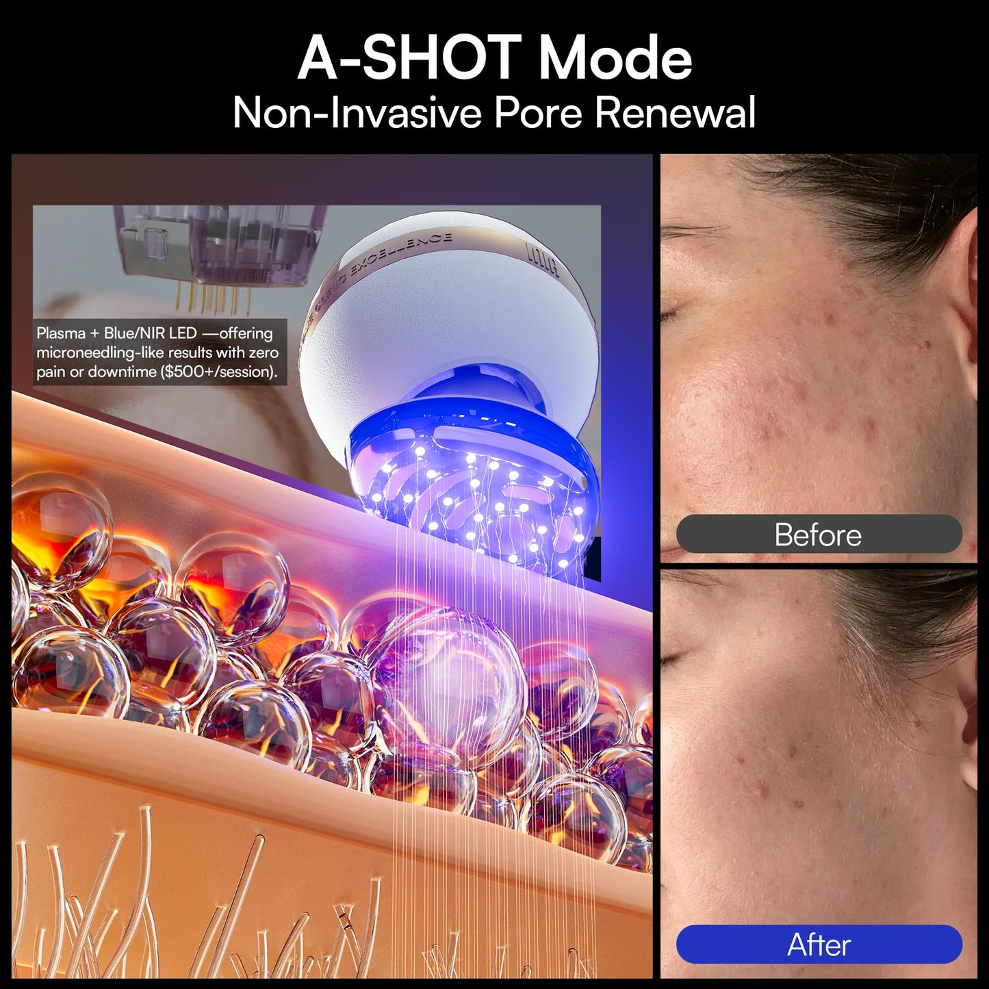 INIA SPHERA Upgraded 8-in-1 Microcurrent Facial Device for Face & Neck – Red Light, Thermal & Cooling Beauty Tool, 5 Custom Modes, At-Home Skin Stimulation & Glow Care Skincare Tool