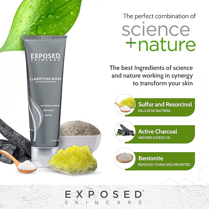 Exposed Skin Care Activated Charcoal Face Mask to Purify Skin, Regulate Oil Production and Visibly Minimize Pores ??Clarifying Acne Treatment Mask with Bentonite and Sulfur (1.7 Fl. Oz.)