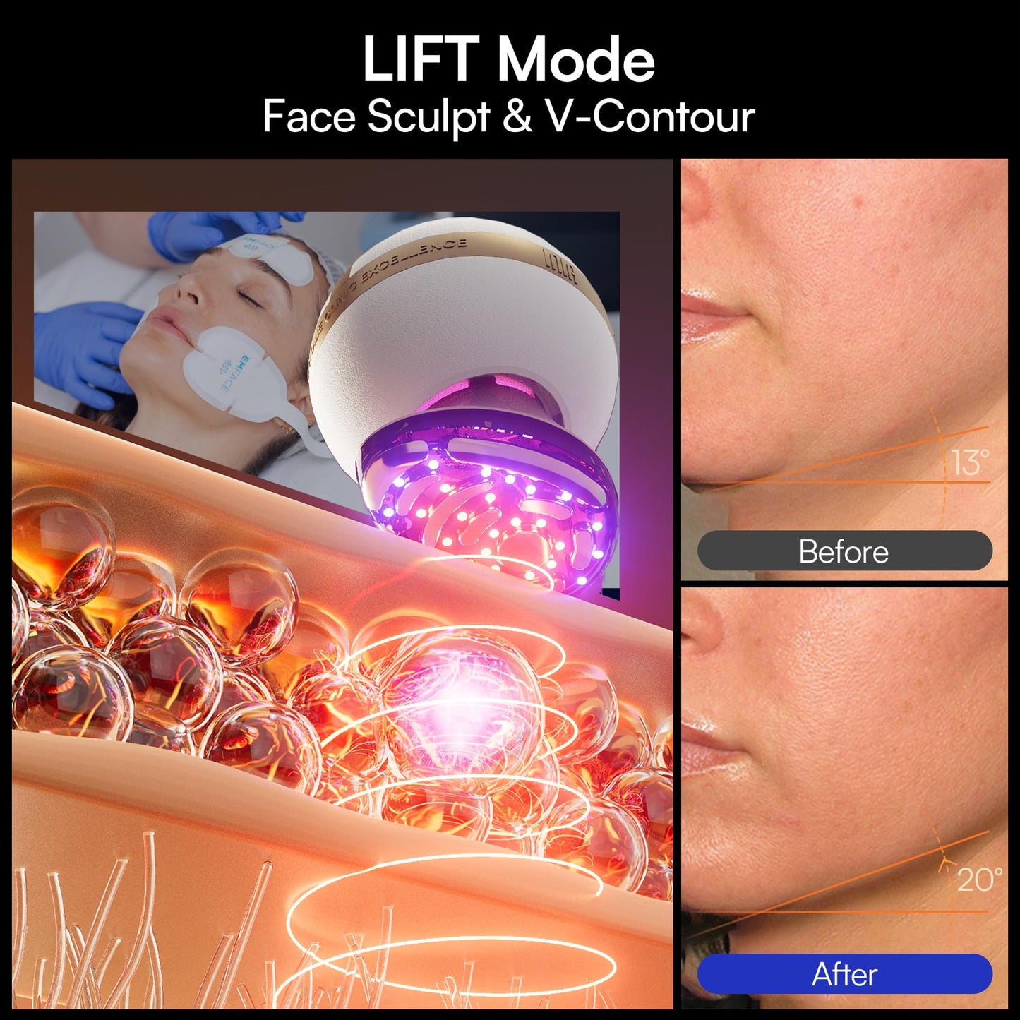 INIA SPHERA Upgraded 8-in-1 Microcurrent Facial Device for Face & Neck – Red Light, Thermal & Cooling Beauty Tool, 5 Custom Modes, At-Home Skin Stimulation & Glow Care Skincare Tool