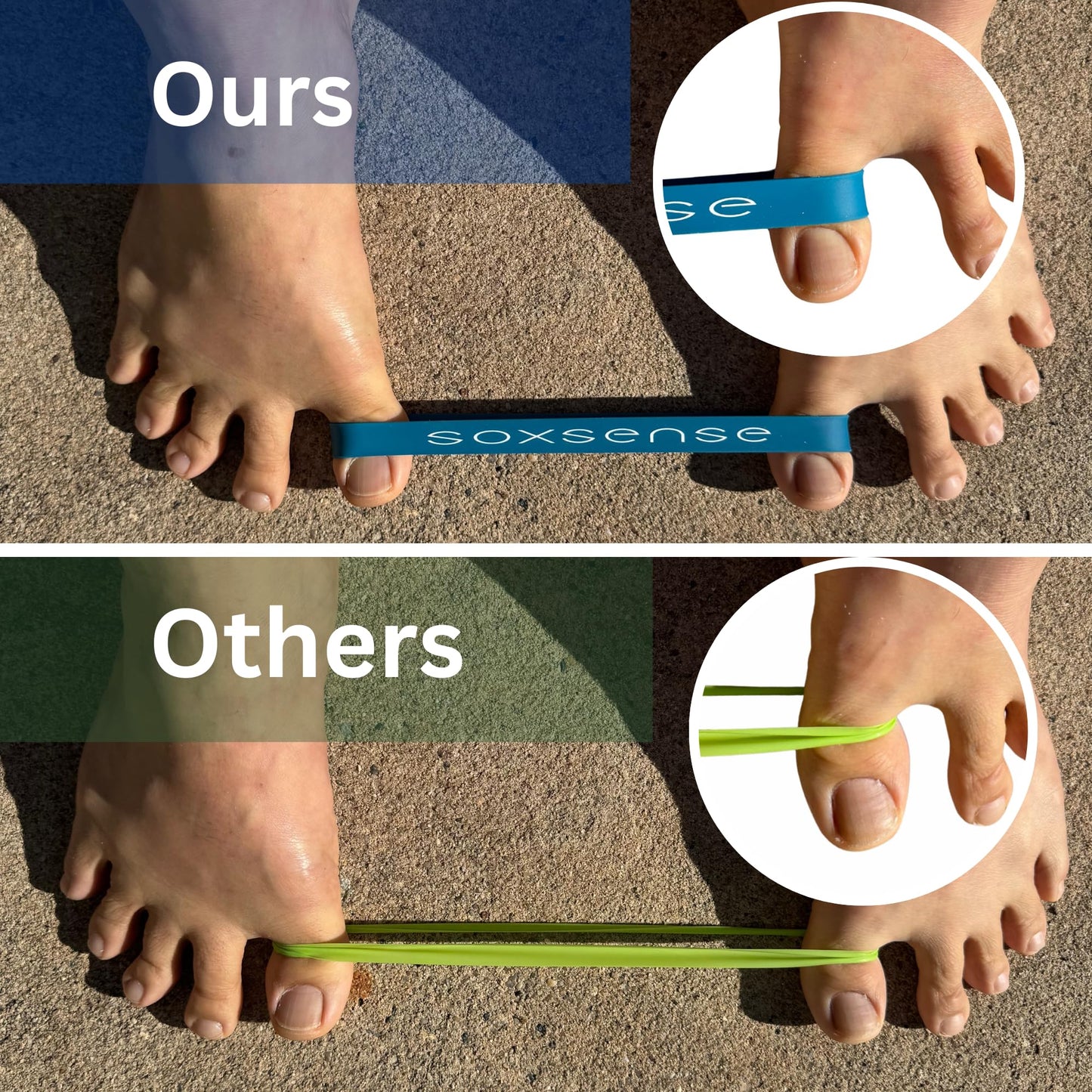 Soxsense Toe Stretcher Bands - Toe Spacers for Bunion Correction, Hallux Valgus Corrector, Foot Stretcher Resistance Band for Bunion Relief 2 PCS